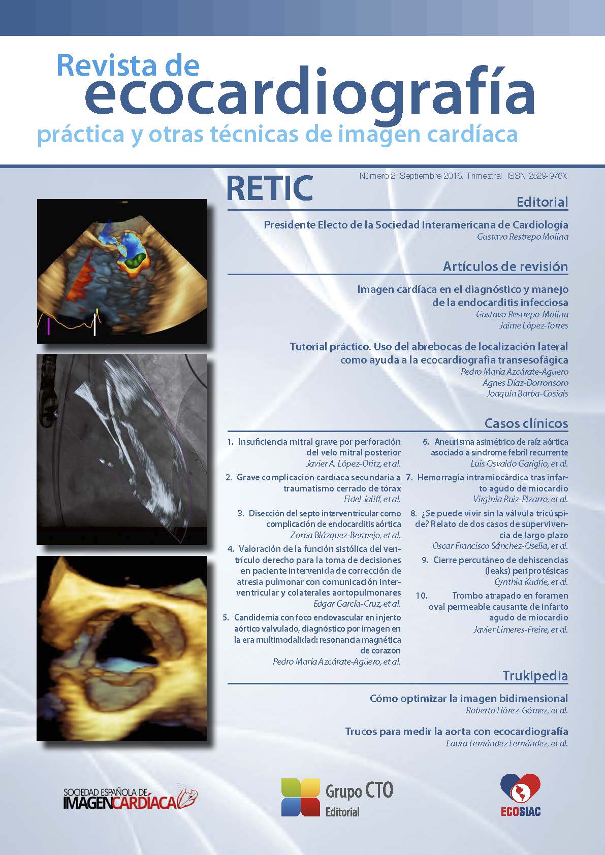 					Ver Núm. 2 (2016): Revista de Ecocardiografía Práctica y Otras Técnicas de Imagen Cardíaca
				