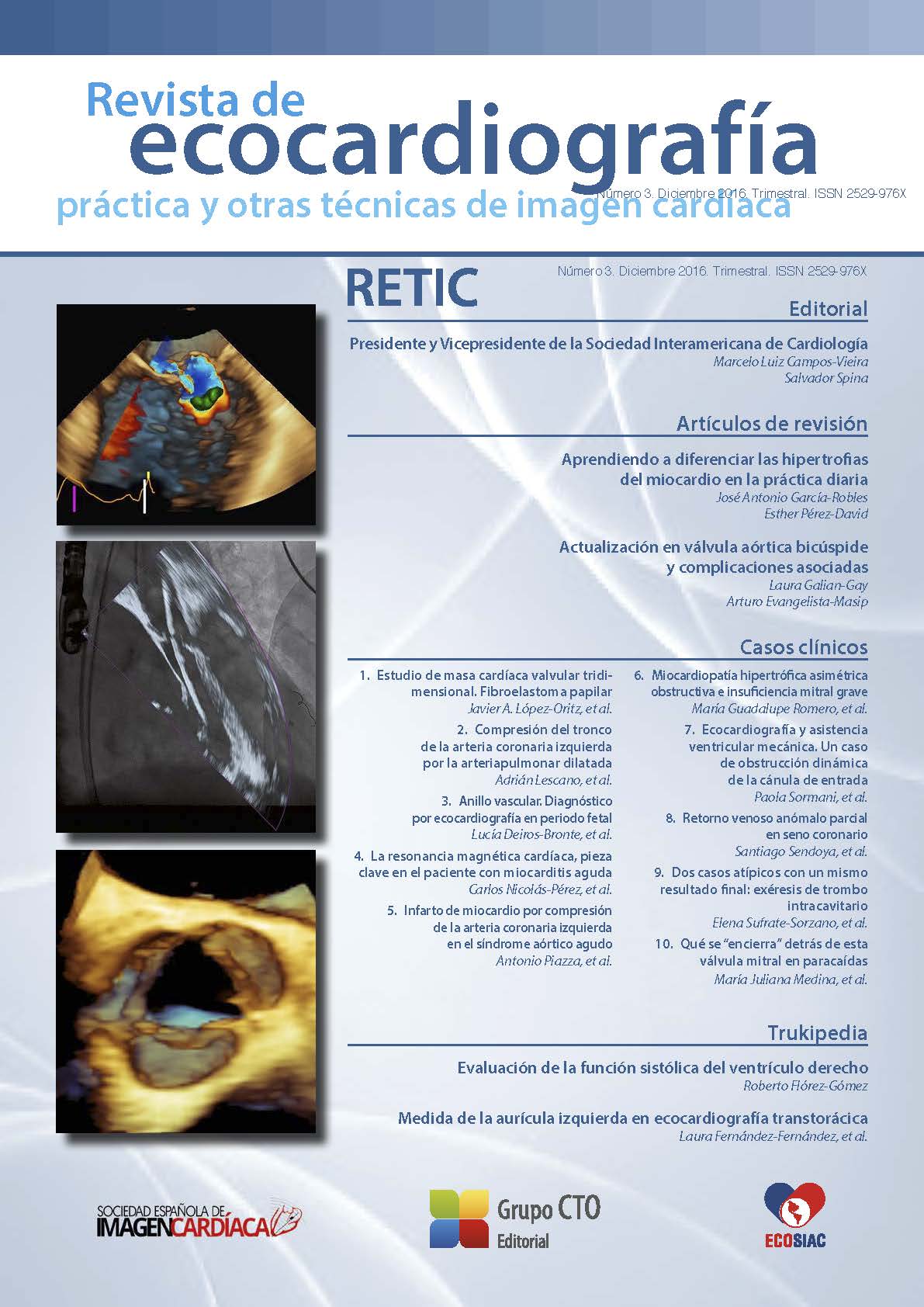					Ver Núm. 3 (2016): Revista de Ecocardiografía Práctica y Otras Técnicas de Imagen Cardíaca
				