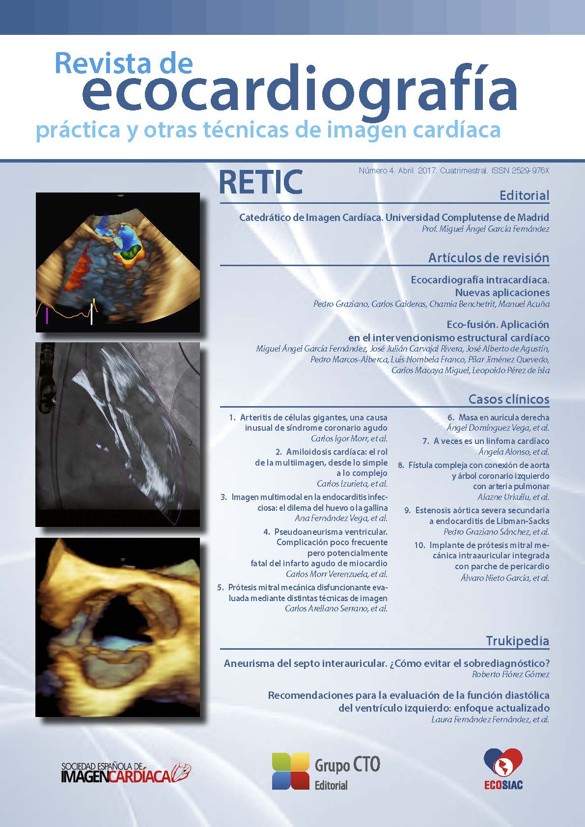 					Ver Núm. 4 (2017): Revista de Ecocardiografía Práctica y Otras Técnicas de Imagen Cardíaca
				