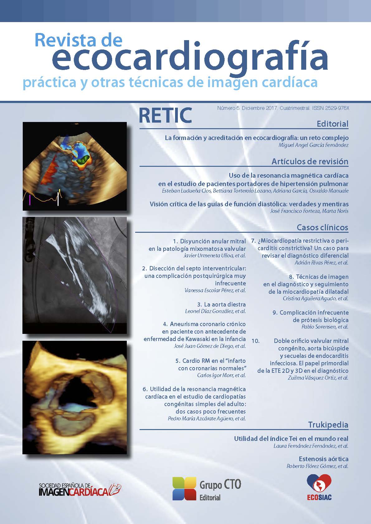 					Ver Núm. 6 (2017): Revista de Ecocardiografía Práctica y Otras Técnicas de Imagen Cardíaca
				