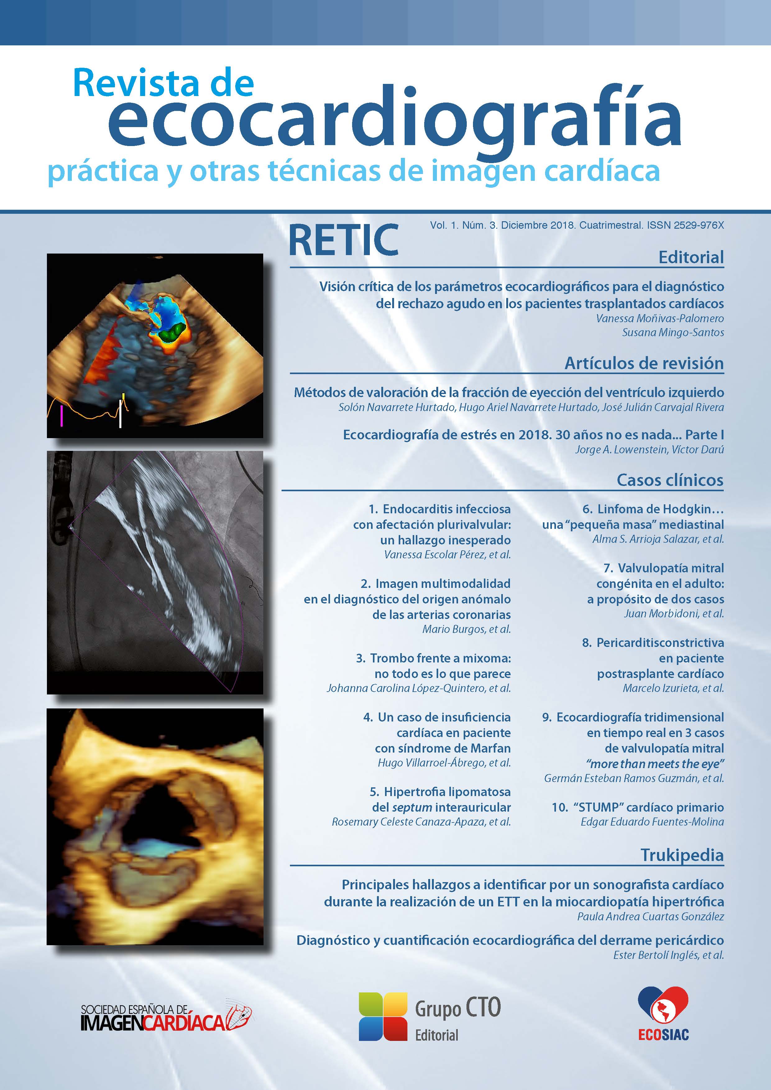 					Ver Vol. 1 Núm. 3 (2018): Revista de Ecocardiografía Práctica y Otras Técnicas de Imagen Cardíaca
				