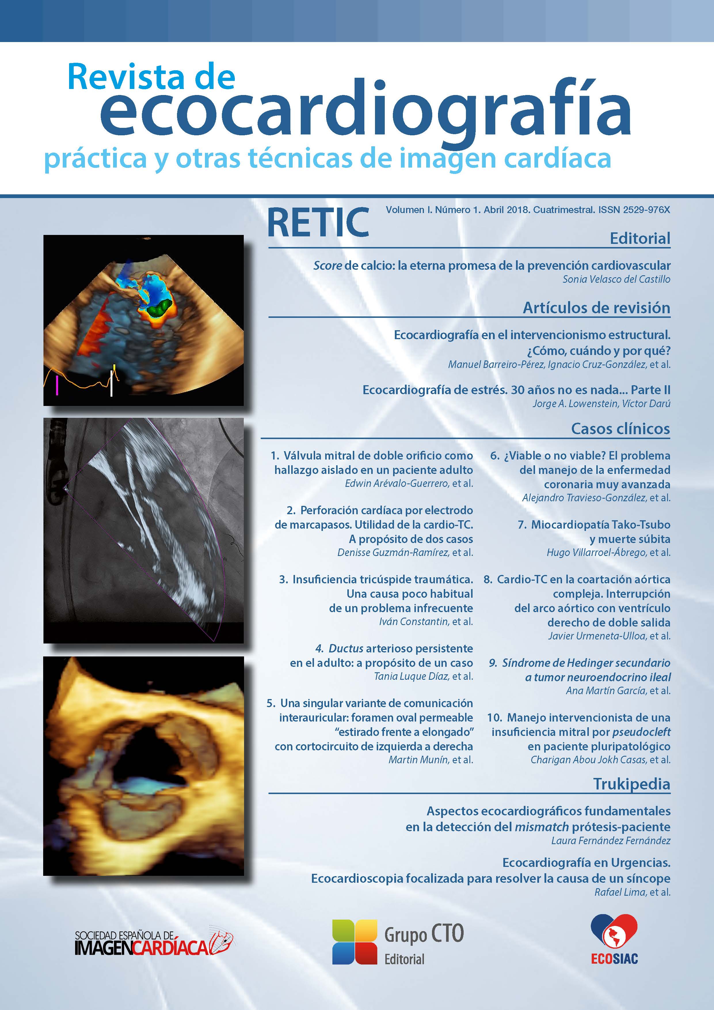 					Ver Vol. 1 Núm. 1 (2018): Revista de Ecocardiografía Práctica y Otras Técnicas de Imagen Cardíaca
				