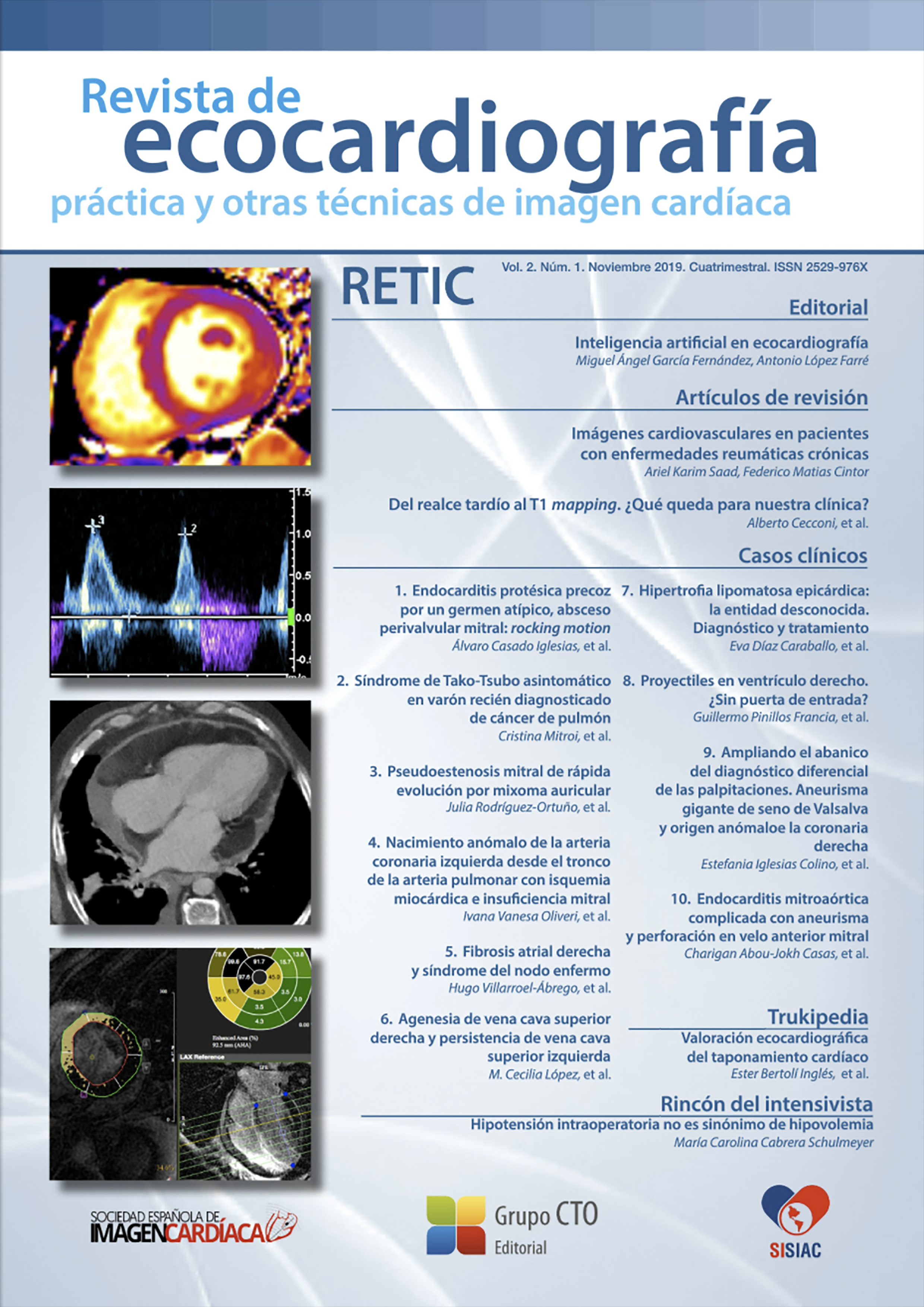 					Ver Vol. 2 Núm. 1 (2019): Revista de Ecocardiografía Práctica y Otras Técnicas de Imagen Cardíaca
				