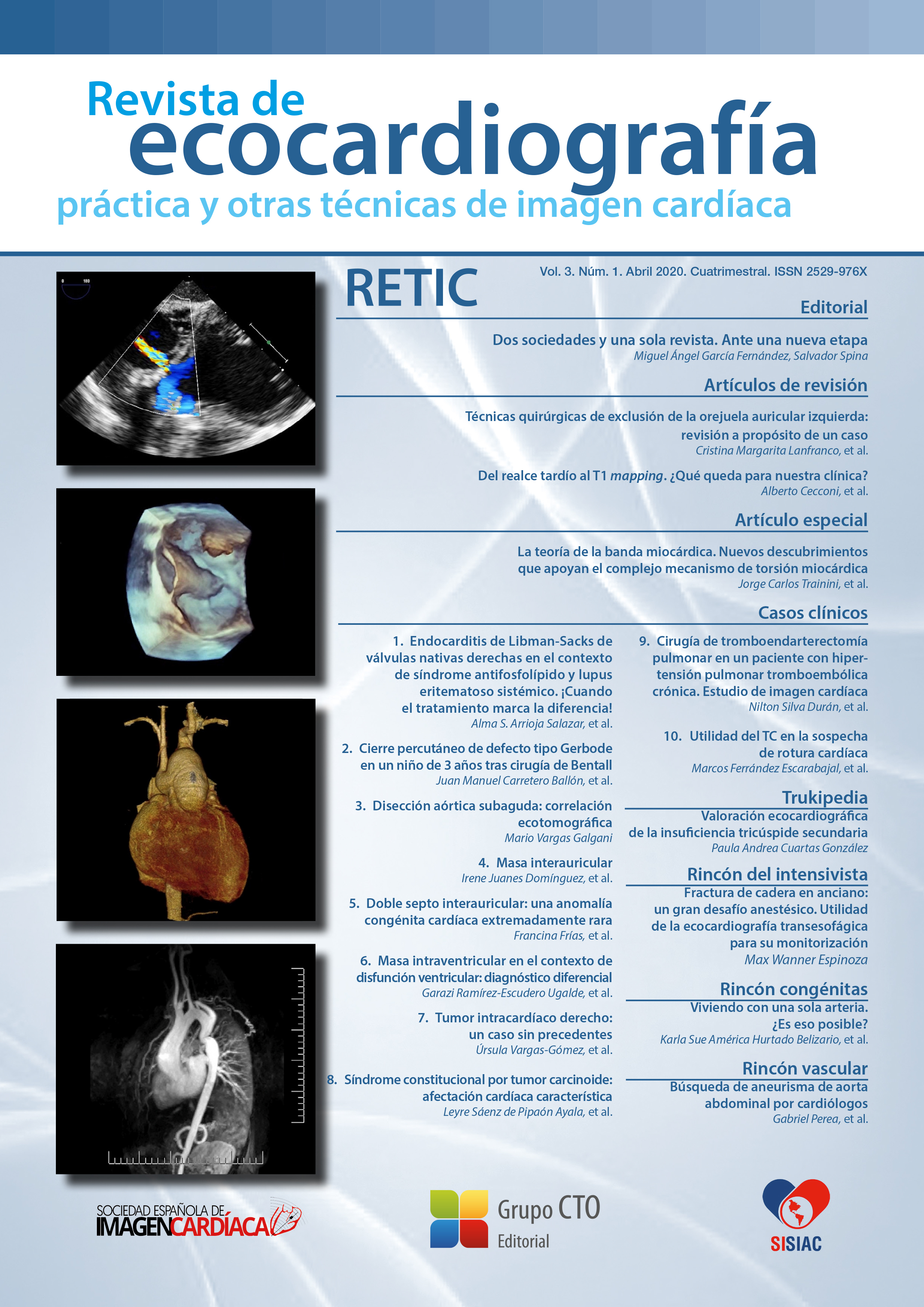 					Ver Vol. 3 Núm. 1 (2020): Revista de Ecocardiografía Práctica y Otras Técnicas de Imagen Cardíaca
				