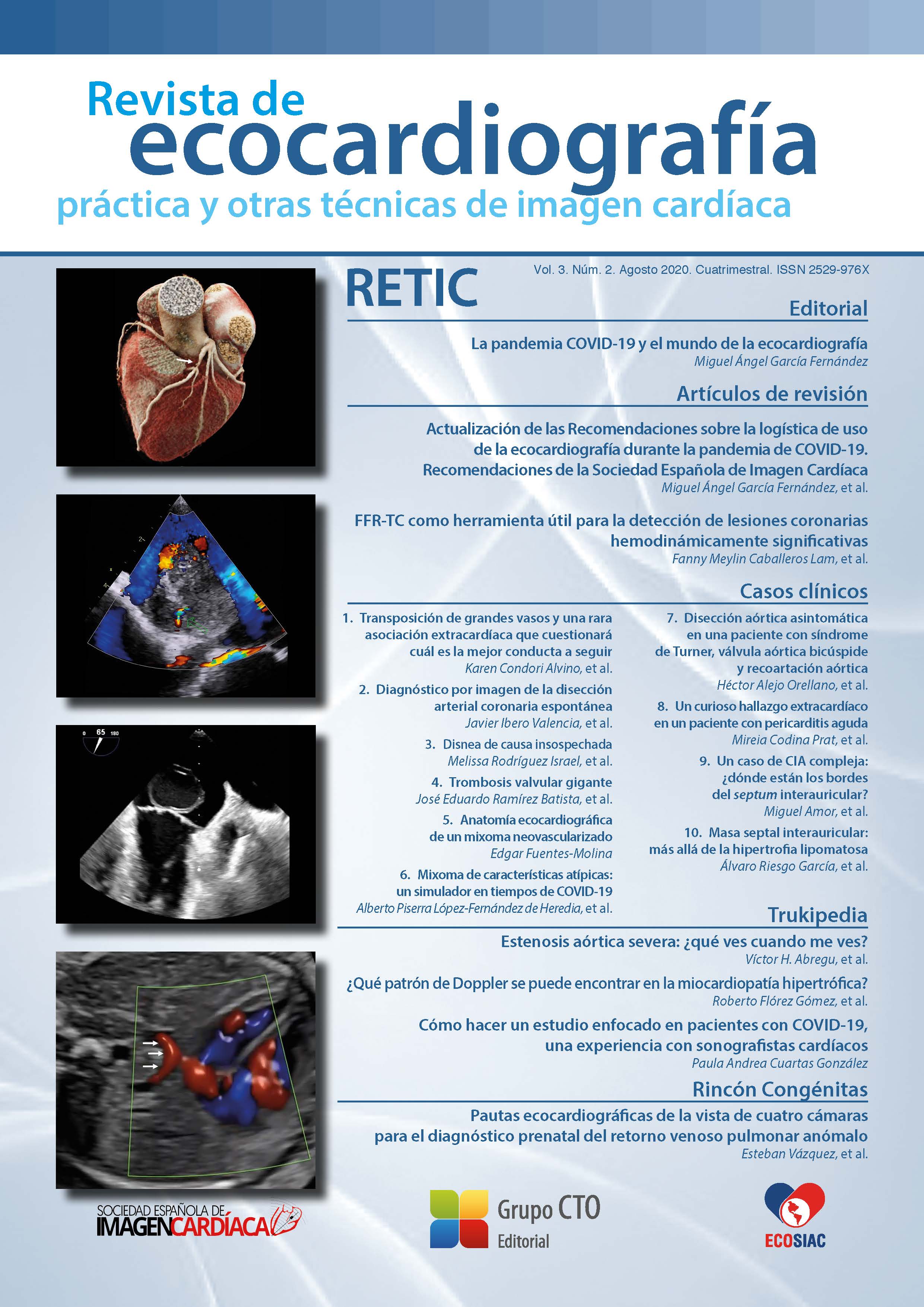 					Ver Vol. 3 Núm. 2 (2020): Revista de Ecocardiografía Práctica y Otras Técnicas de Imagen Cardíaca
				