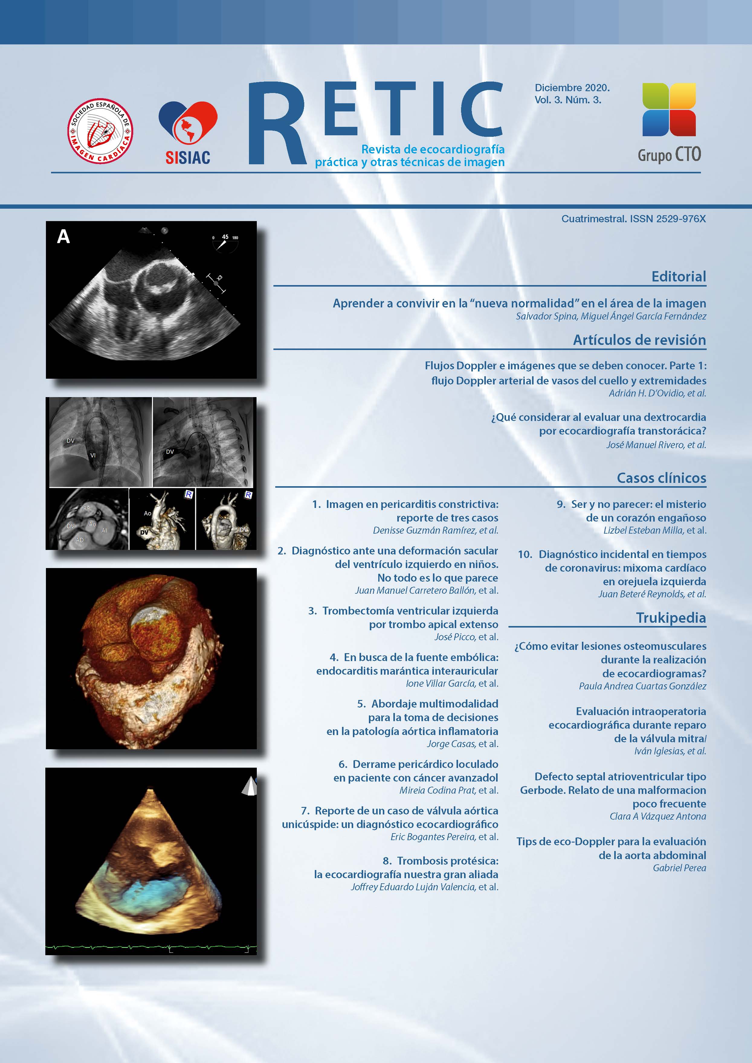 					Ver Vol. 3 Núm. 3 (2020): Revista de Ecocardiografía Práctica y Otras Técnicas de Imagen Cardíaca
				