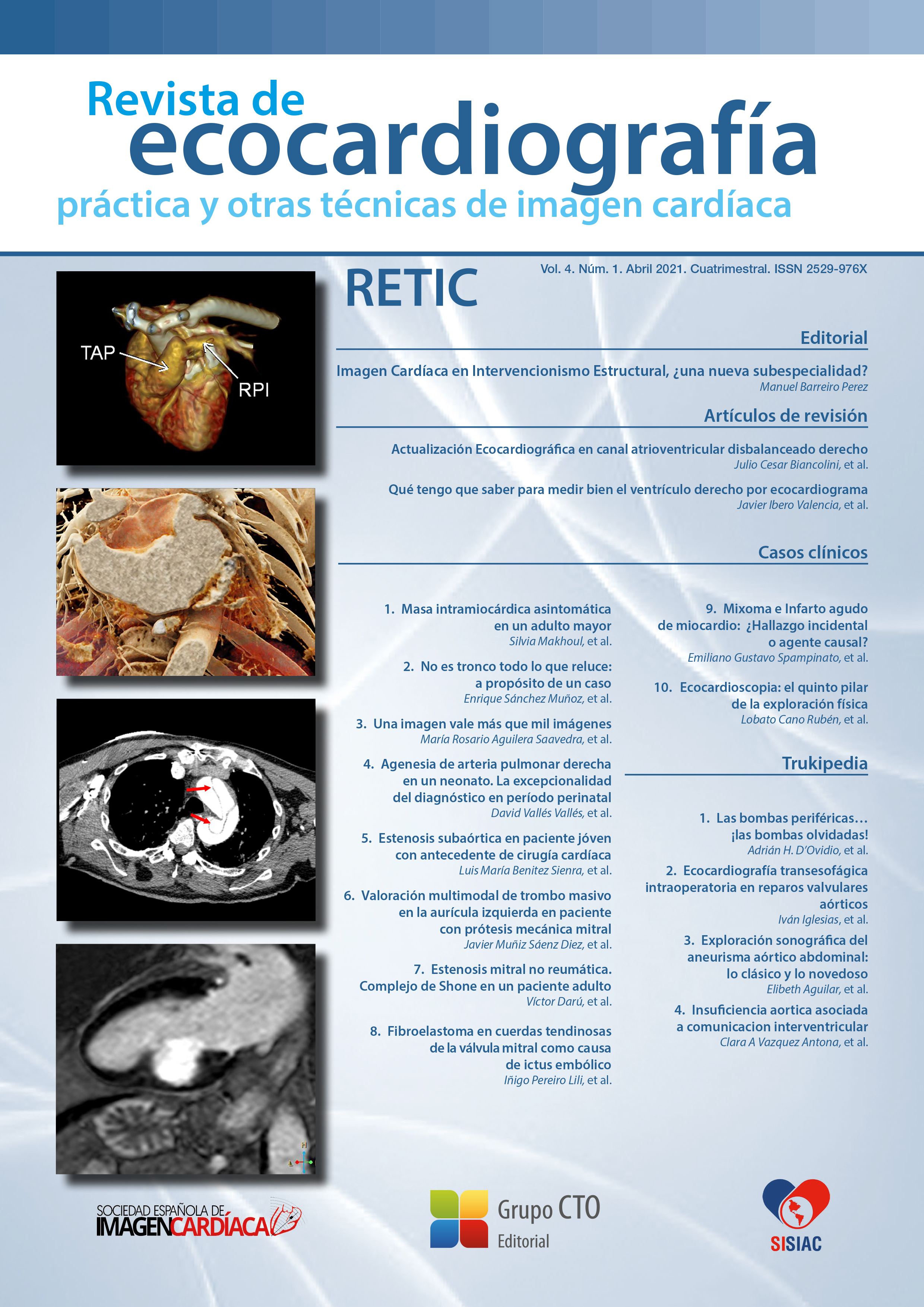 					Ver Vol. 4 Núm. 1 (2021): Revista de Ecocardiografía Práctica y Otras Técnicas de Imagen Cardíaca
				