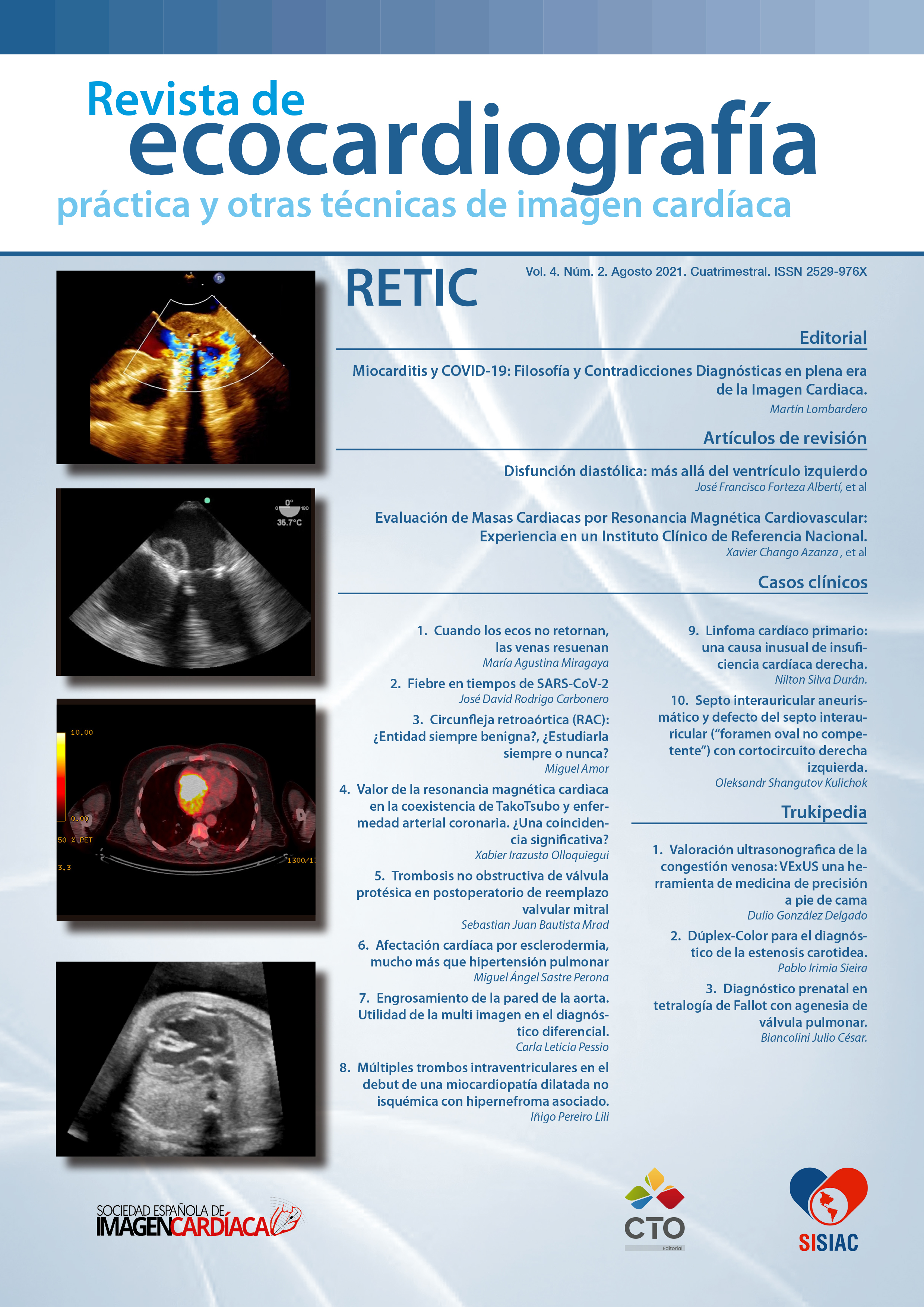 					Ver Vol. 4 Núm. 2 (2021):  Revista de Ecocardiografía Práctica y Otras Técnicas de Imagen Cardíaca
				