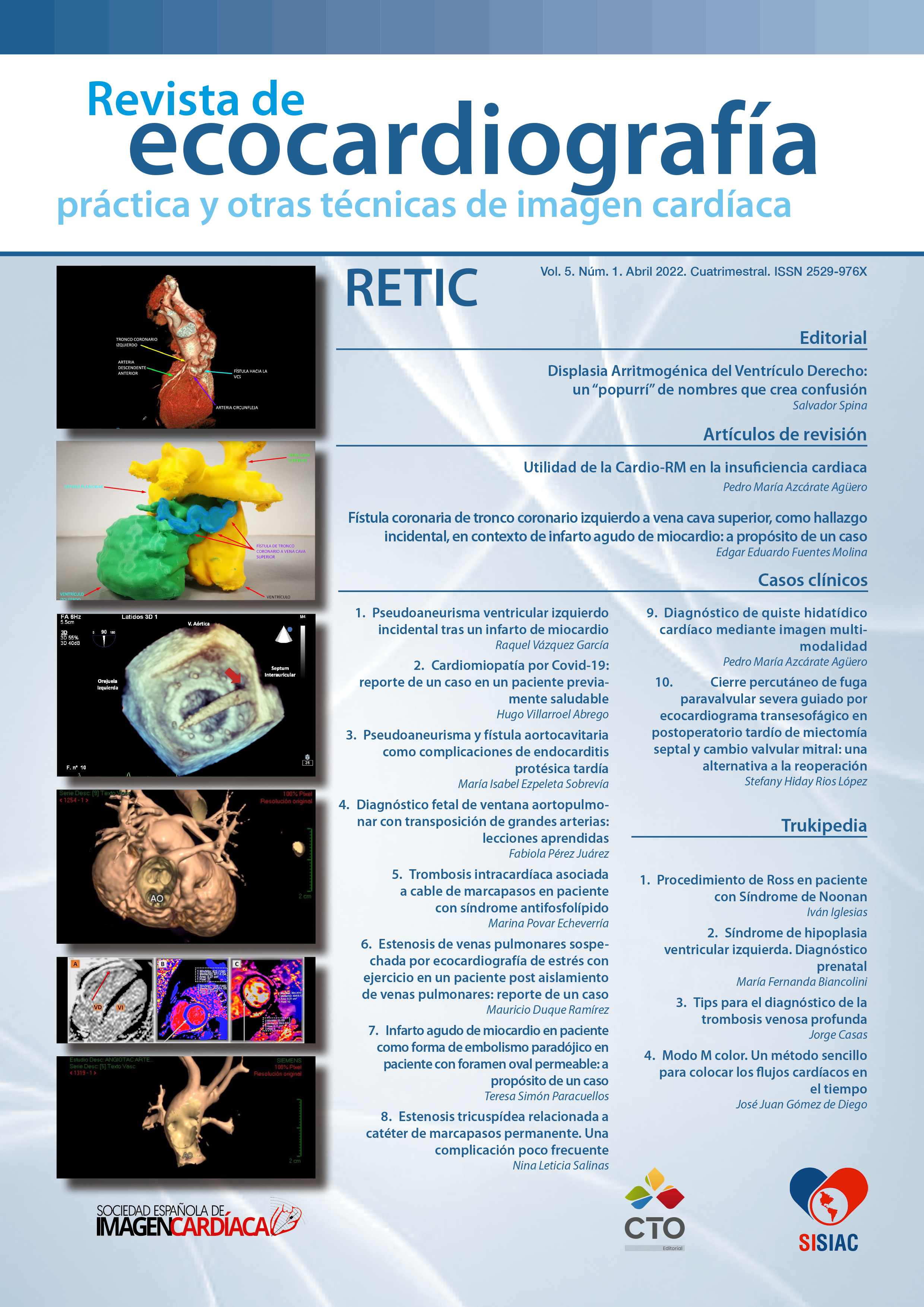 					Ver Vol. 5 Núm. 1 (2022): Revista de Ecocardiografía Práctica y Otras Técnicas de Imagen Cardíaca
				