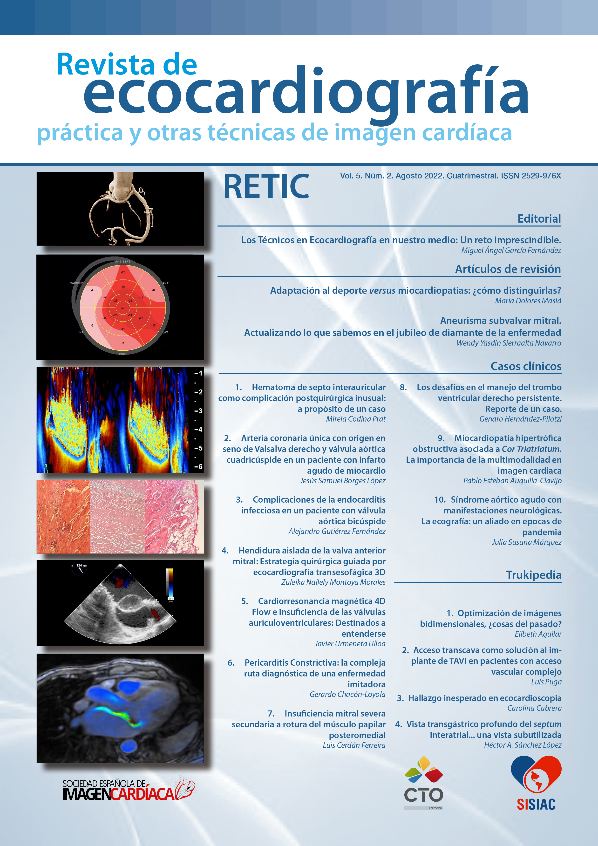 					Ver Vol. 5 Núm. 2 (2022): Revista de Ecocardiografía Práctica y Otras Técnicas de Imagen Cardíaca
				