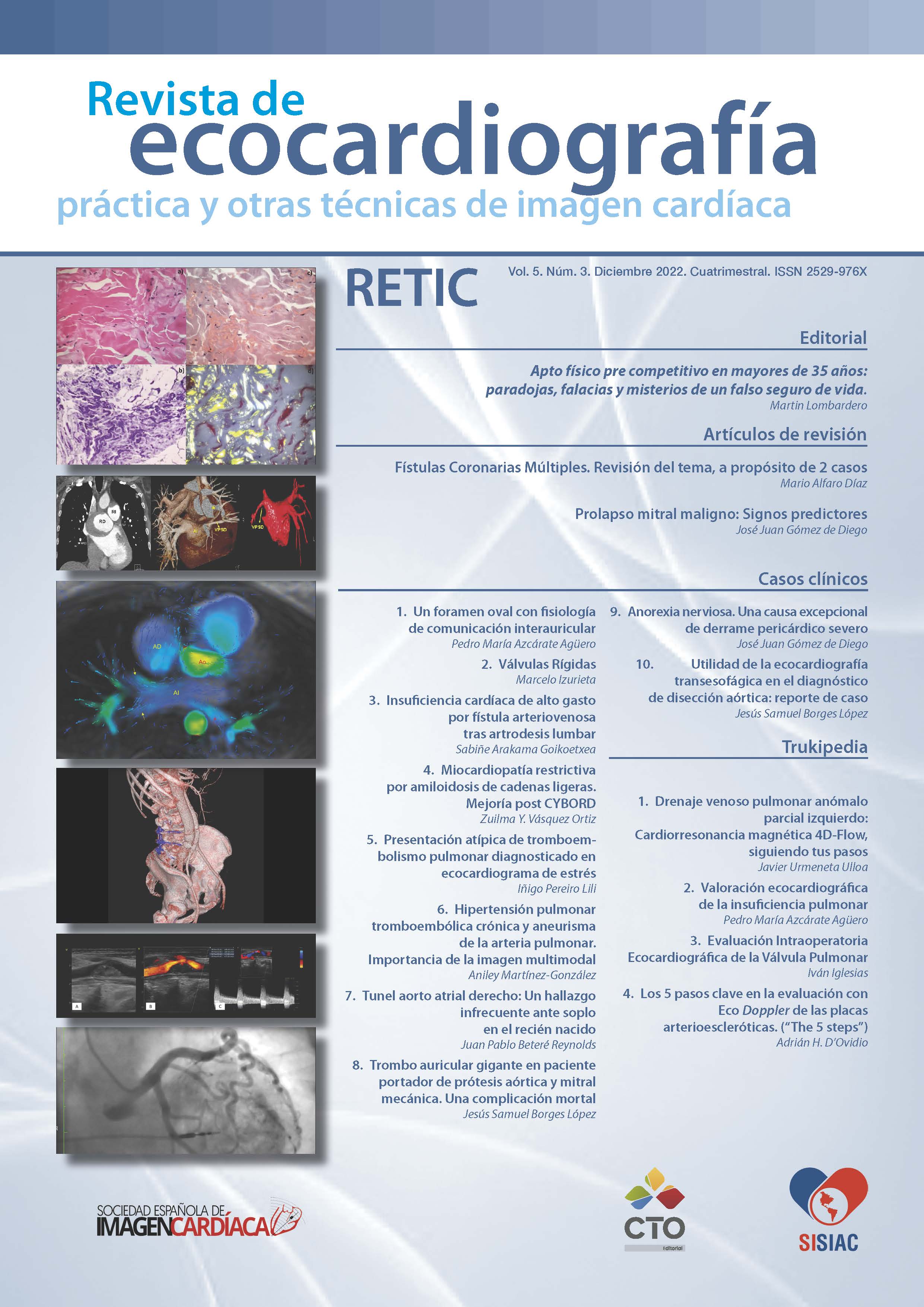 					Ver Vol. 5 Núm. 3 (2022): Revista de Ecocardiografía Práctica y Otras Técnicas de Imagen Cardíaca
				