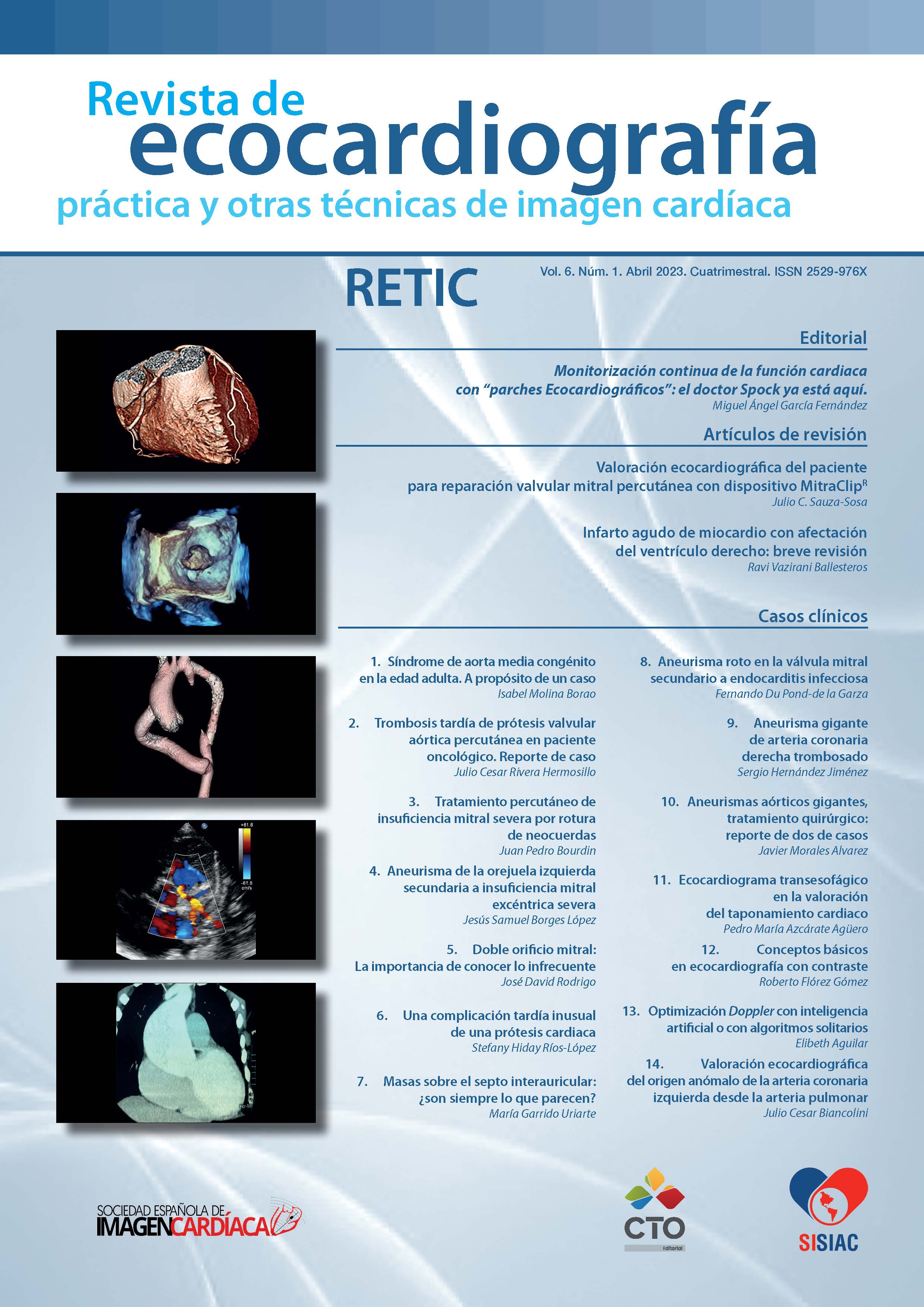 					Ver Vol. 6 Núm. 1 (2023): Revista de Ecocardiografía Práctica y Otras Técnicas de Imagen Cardíaca
				