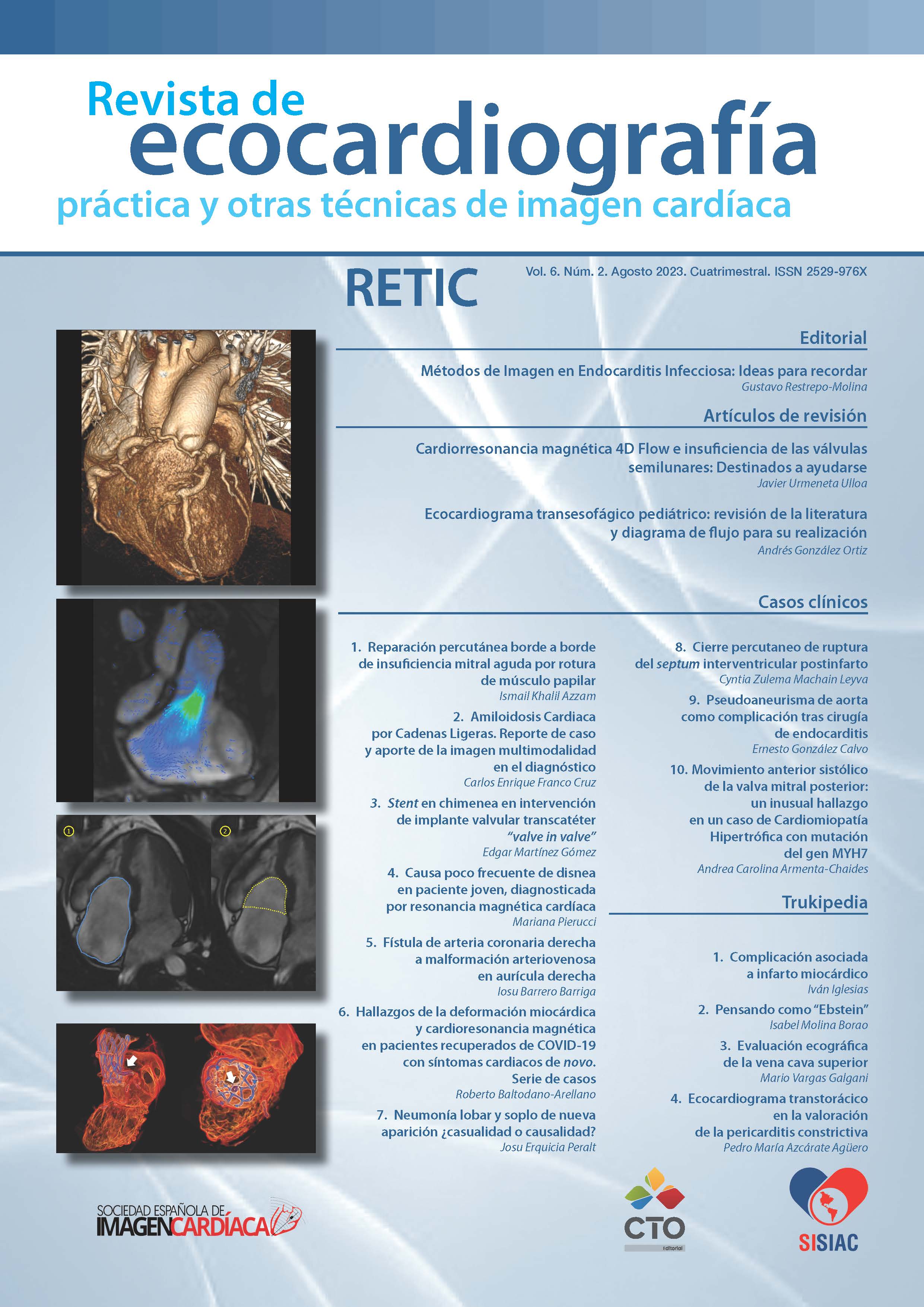 					Ver Vol. 6 Núm. 2 (2023): Revista de Ecocardiografía Práctica y Otras Técnicas de Imagen Cardíaca
				