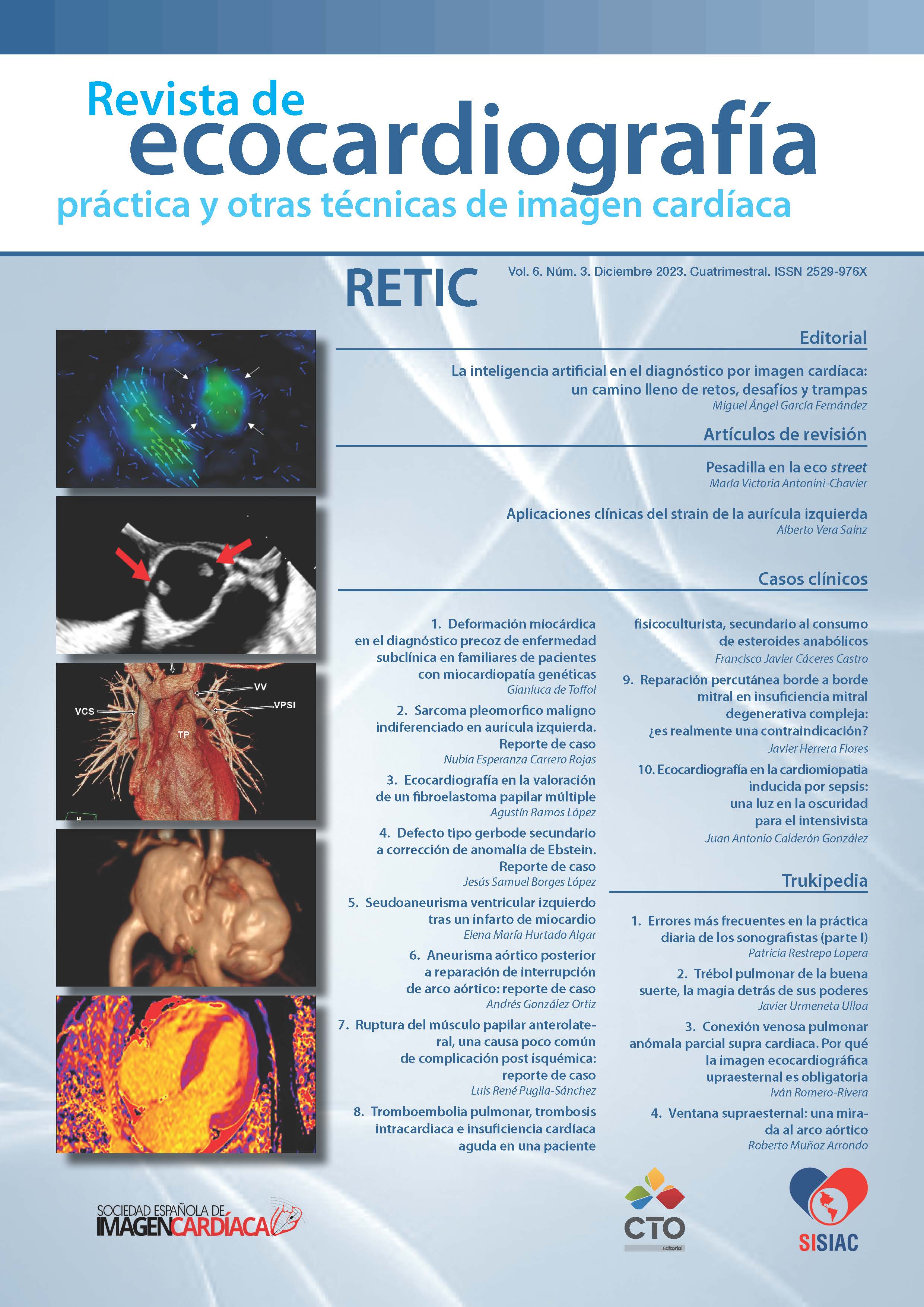 					Ver Vol. 6 Núm. 3 (2023): Revista de Ecocardiografía Práctica y Otras Técnicas de Imagen Cardíaca
				