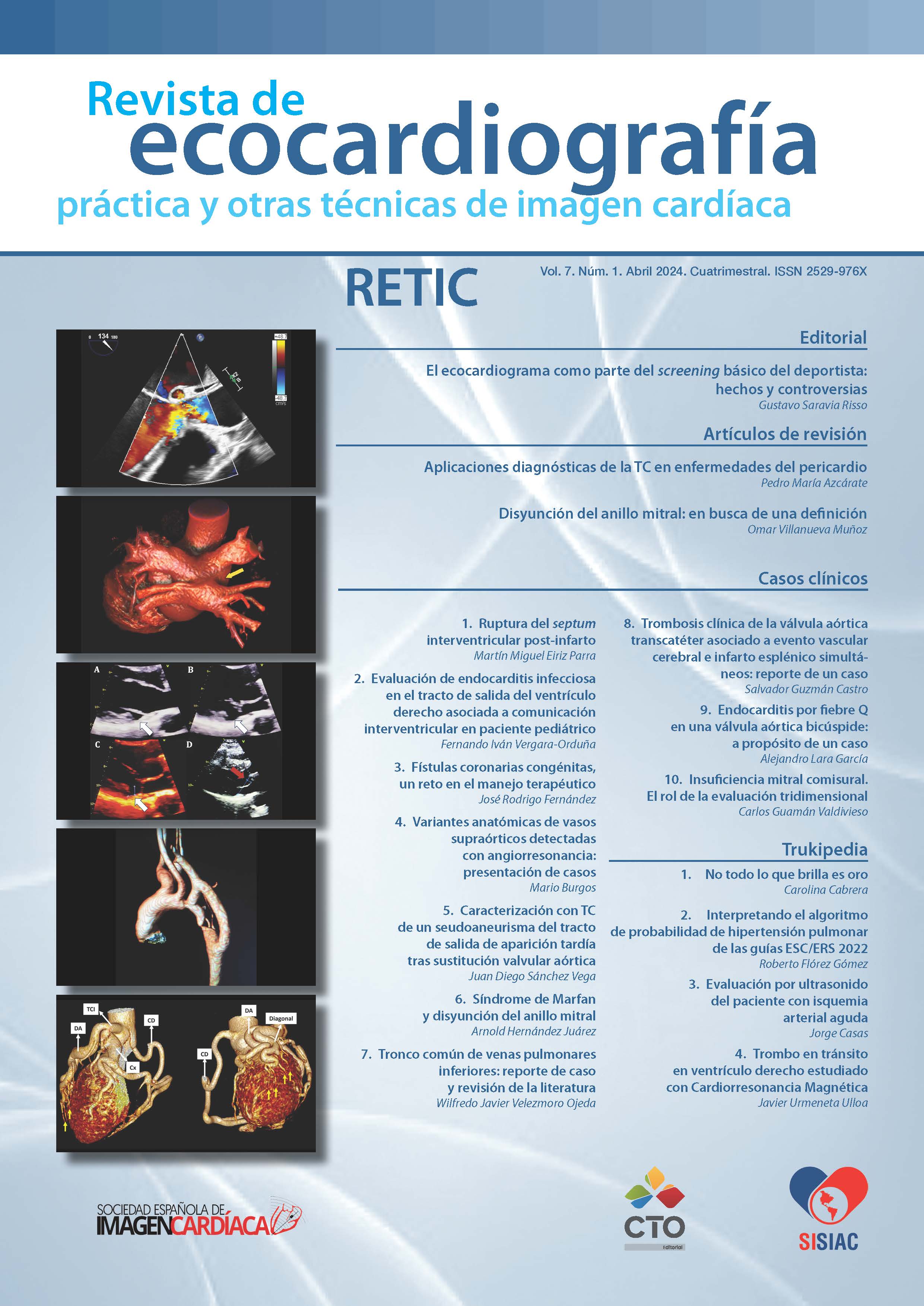 					View Vol. 7 No. 1 (2024): Revista de Ecocardiografía Práctica y Otras Técnicas de Imagen Cardíaca
				