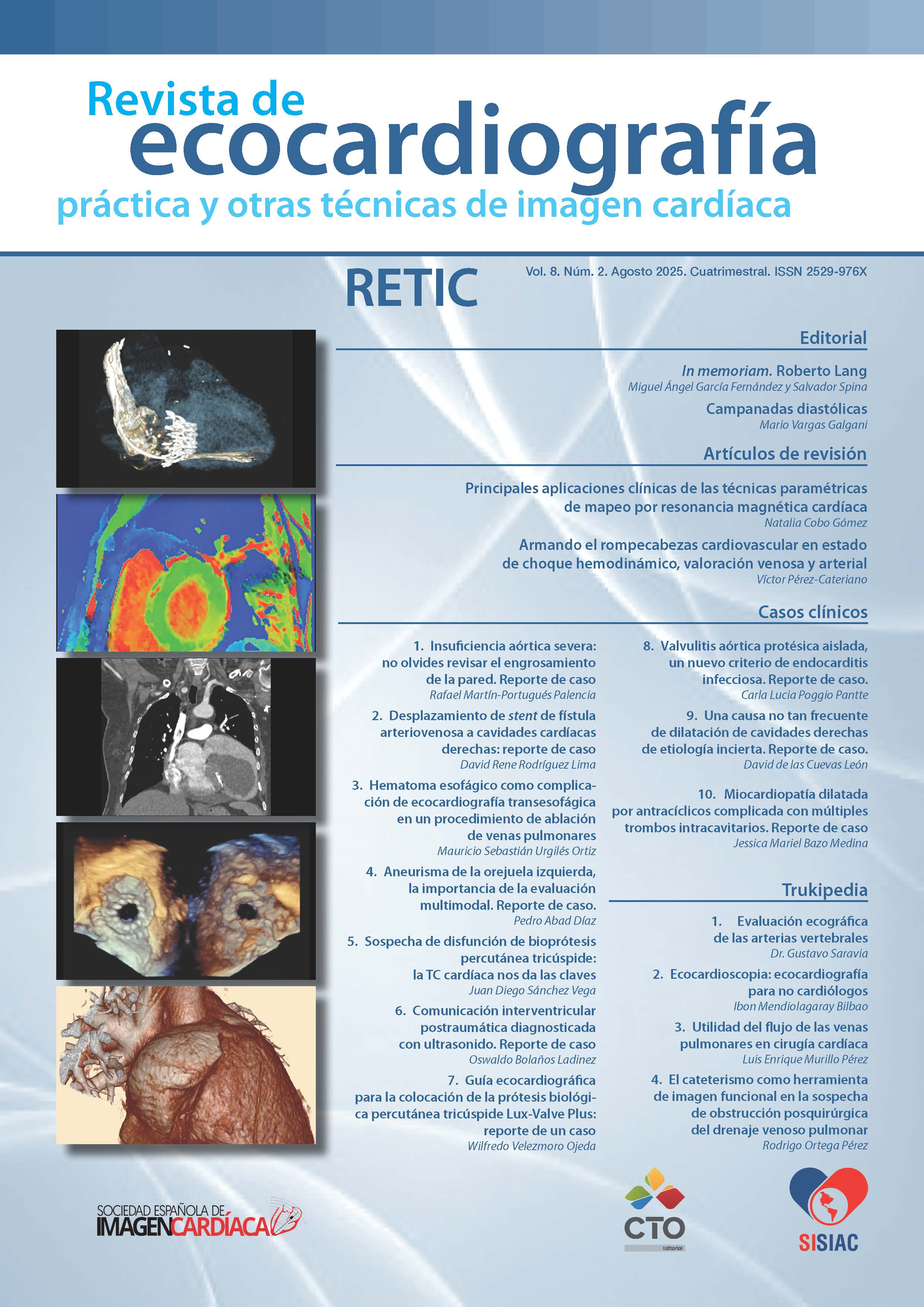 Ver Vol. 8 Núm. 2 (2025): Revista de Ecocardiografía Práctica y Otras Técnicas de Imagen Cardíaca