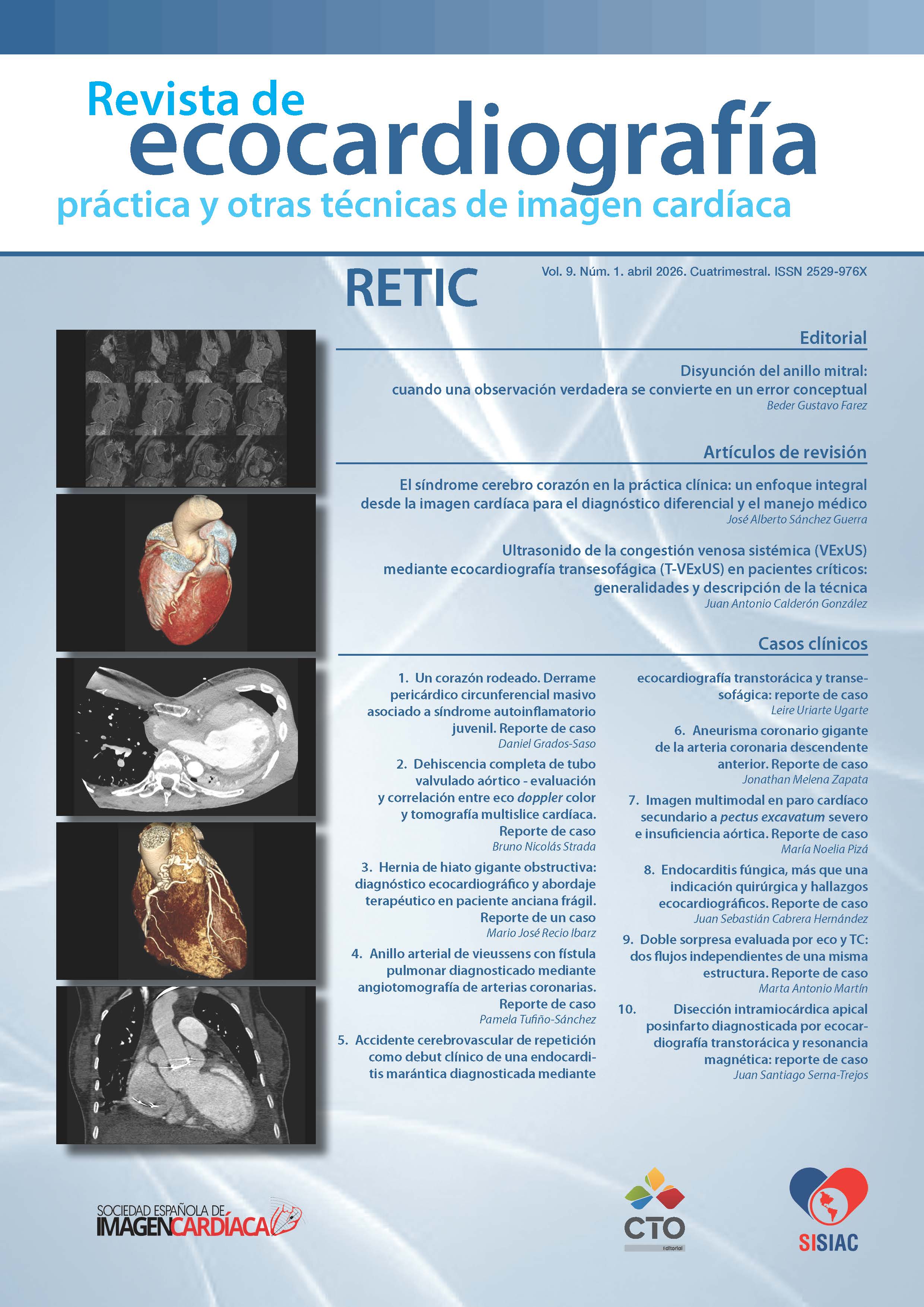 					Ver Vol. 9 Núm. 1 (2026): Revista de Ecocardiografía Práctica y Otras Técnicas de Imagen Cardíaca
				